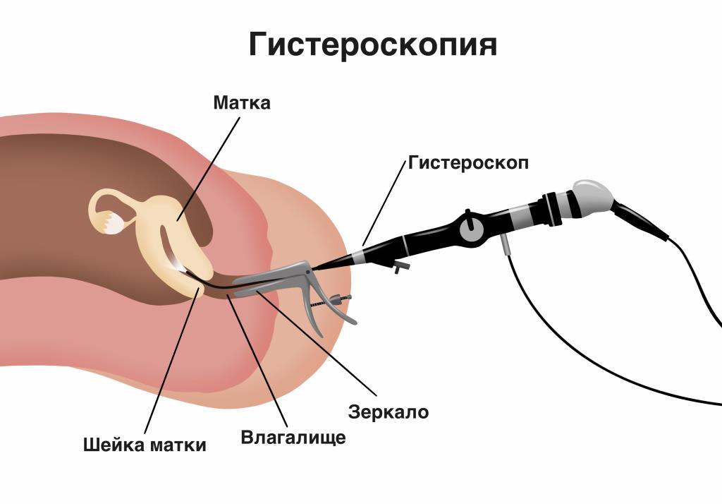 Гинеколог-эстетист